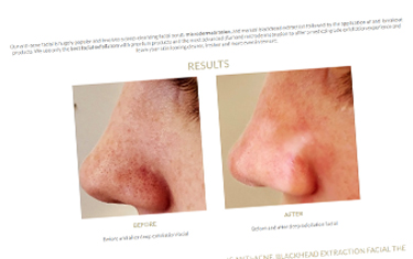 Treatment Pages